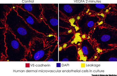 test blood vessel permeability|in vivo vascular permeability.